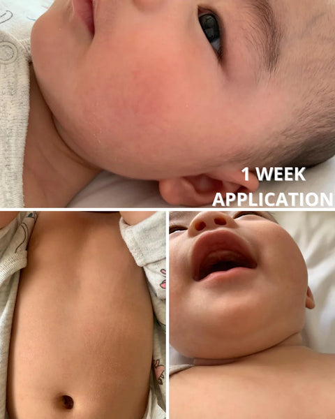 Botanical Therapy｜嬰兒面霜｜200mL｜桃味 - Breastpump City